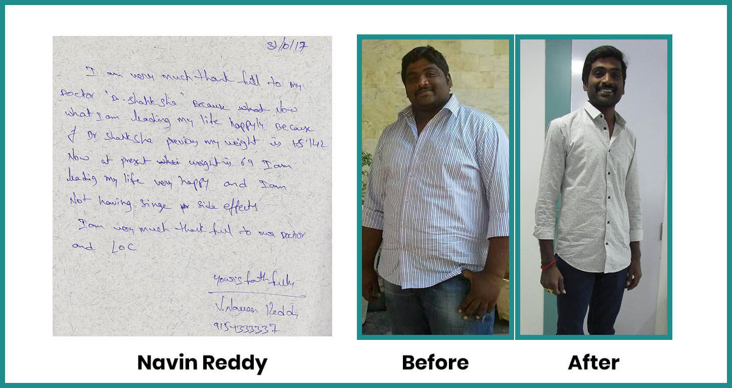 obesity patient testimonial | obesity patient weight loss journey | how to lose weight | bariatric patient testimonial | Dr Shashank Shah testimonials | weight loss story | patent after bariatric surgery | life after bariatric surgery | patient after bariatric surgery for obesity | obese patient