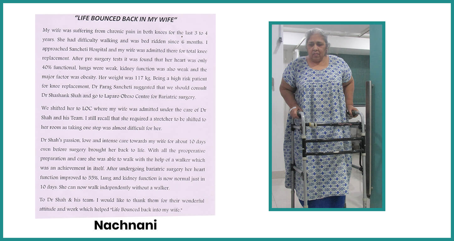 obesity patient testimonial | obesity patient weight loss journey | how to lose weight | bariatric patient testimonial | Dr Shashank Shah testimonials | weight loss story | patent after bariatric surgery | life after bariatric surgery | patient after bariatric surgery for obesity | obese patient