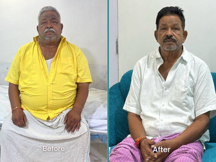 Weight Reduction Patient