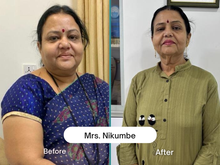 Mrs Nikumbe
