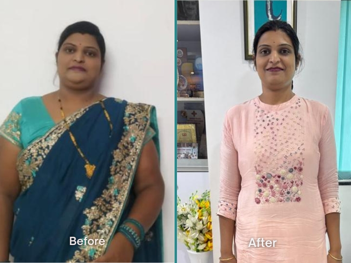 Weight Loss Transformation