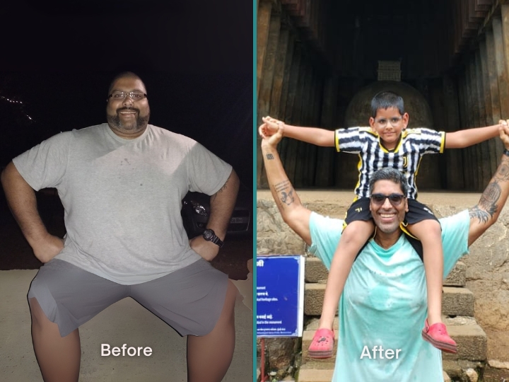 Weight Loss Patient 1
