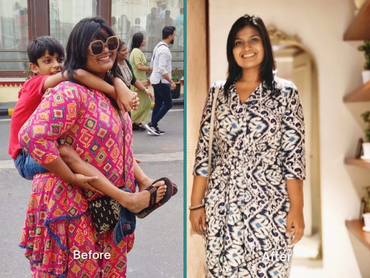 Weight Loss Patient