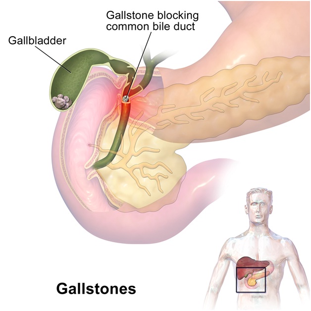 What is a Gall Bladder