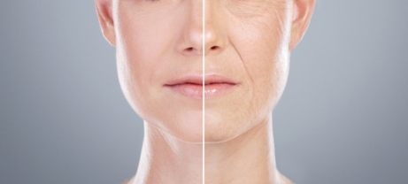 Ageing